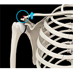 AC Joint Dislocation/Acromioclavicular Joint Dislocation