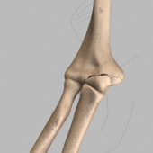 Elbow Fractures