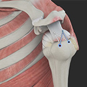 Rotator Cuff Repair