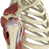 Rotator Cuff Tears