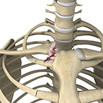 Sternoclavicular Joint Surgery