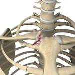 Sternoclavicular (SC) Joint Injuries